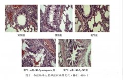 氢气治疗幼年大鼠支气管哮喘机制研究