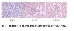 静脉注射含饱和氢气生理盐水减轻小鼠肾脏缺血再灌注损伤