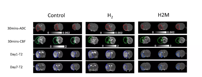 氢气改善脑缺血的最新研究