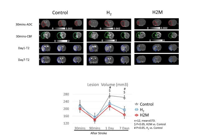 氢水改善脑缺血新证据！