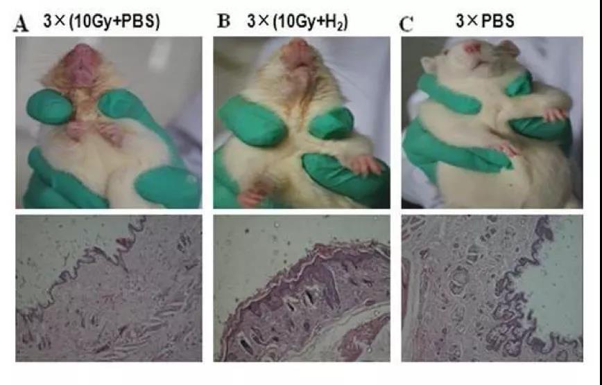 氢气对放射皮肤损伤的改善作用