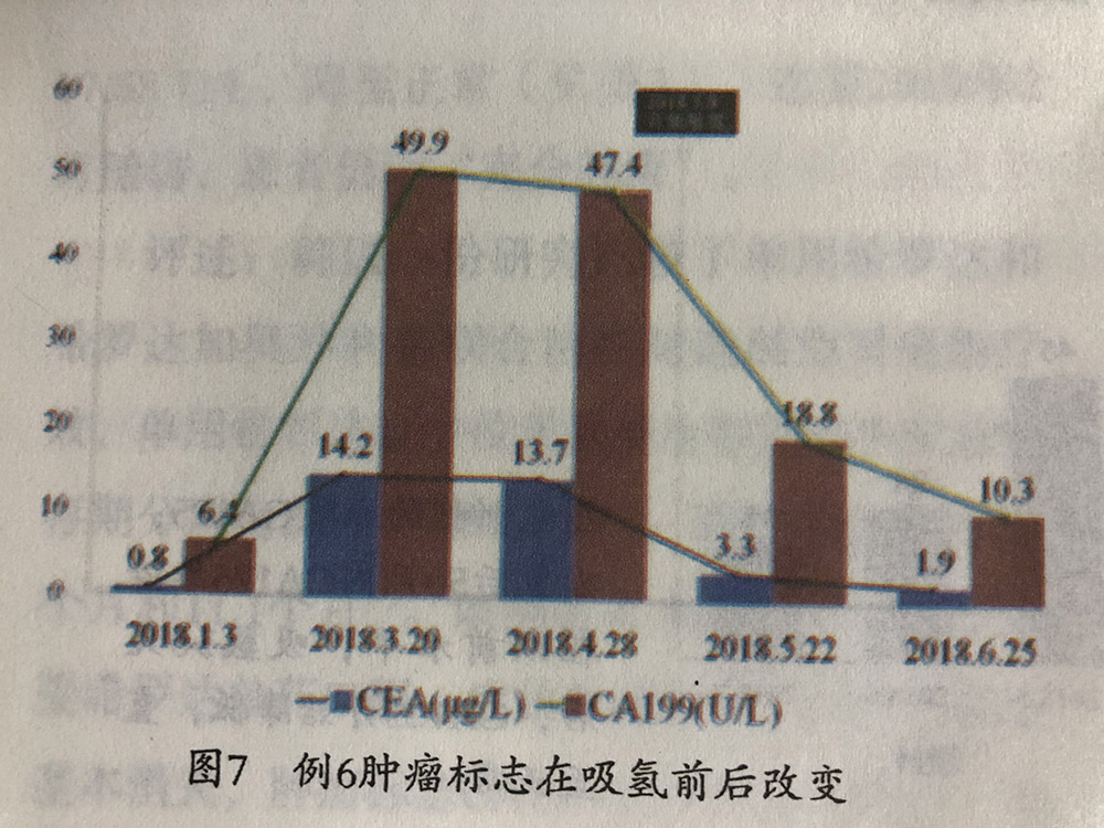 卵巢癌手术后的氢气辅助改善