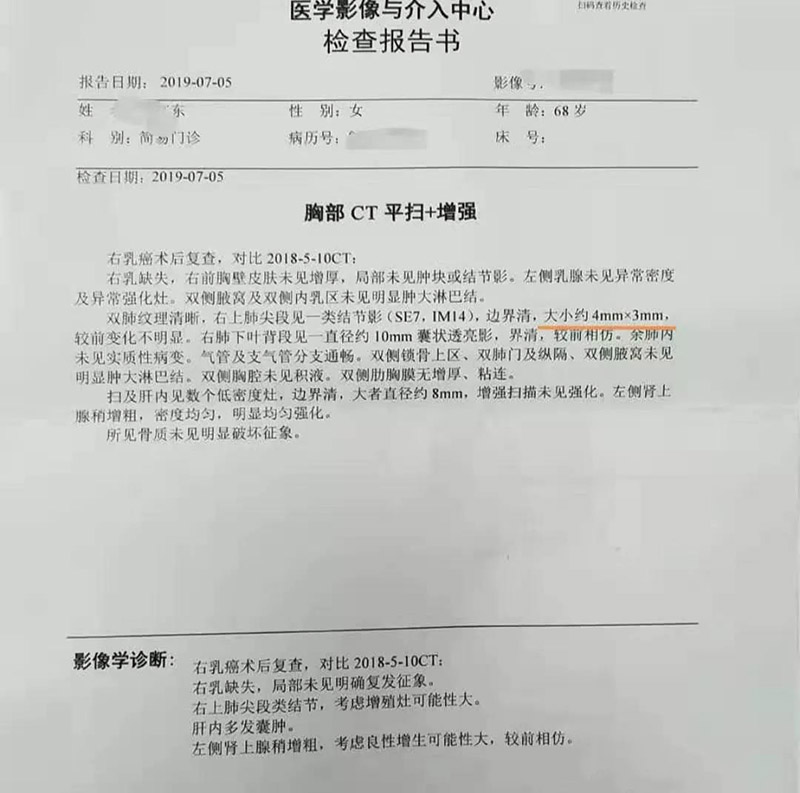 肺结节纠结，吸氢气释怀