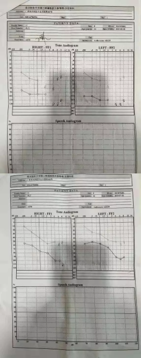 治疗副作用让她几度轻生，吸氢让她焕发新生