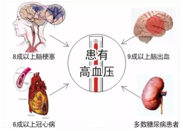 氢气与高血压