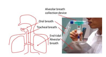 氢呼吸试验采用和分析技术（4）