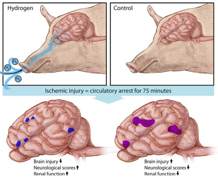 哈佛：氢气保护新生儿大脑