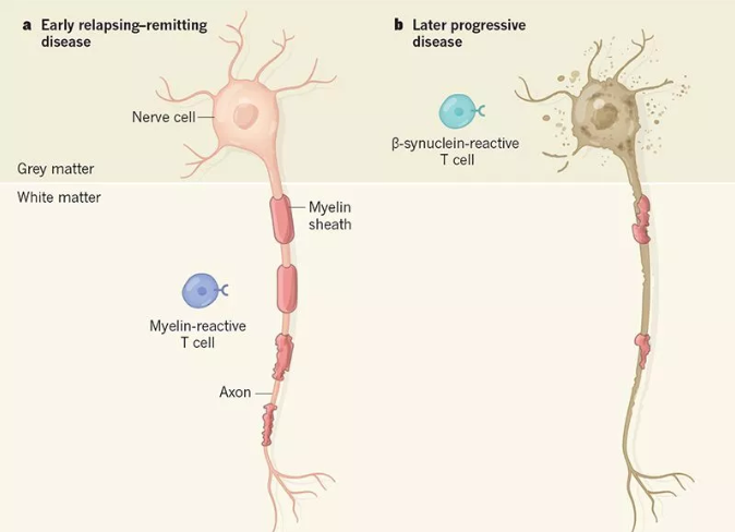从髓鞘坏到神经元死的多发性硬化，氢气能旁观？