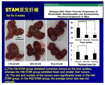 氢气预防癌症的意义（有氢少癌）