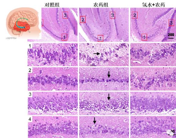 氢气生物学机理：氢气与乙酰胆碱酯酶