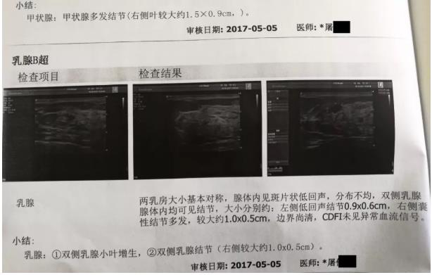 囊肿、息肉、结节，喝氢水都有效果