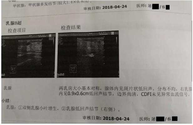 囊肿、息肉、结节，喝氢水都有效果