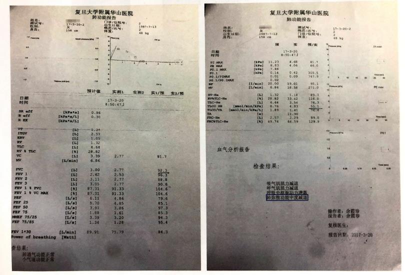 氢气改善结缔组织病相关间质性肺疾病