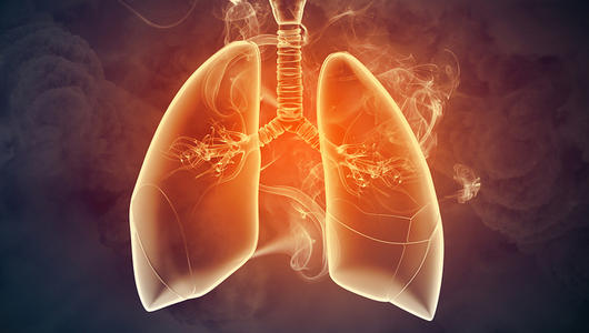 氢分子与慢性阻塞性肺病