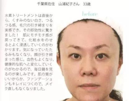 《水素的力量》氢水美容护肤减肥见奇迹