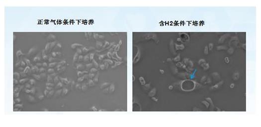 氢改善癌症：他患肝癌，改善很顺畅