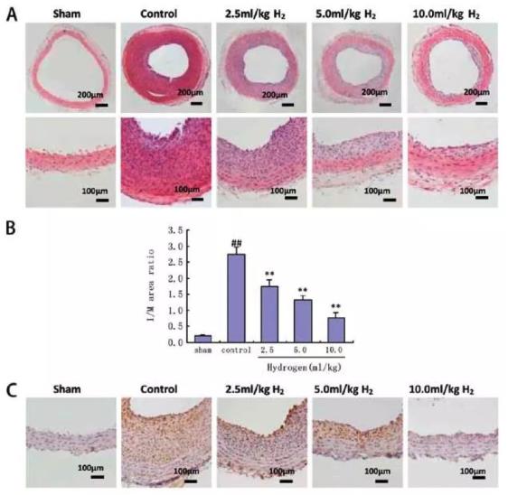 心脏血管内膜增厚可要命，氢气或能解决这个难题