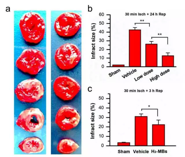 中国科学院：纳米氢气泡能改善心脏缺血