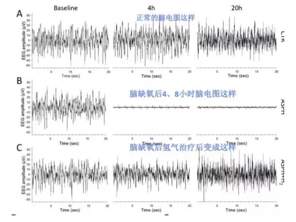 匈牙利：氢气改善缺氧脑损伤的神奇作用