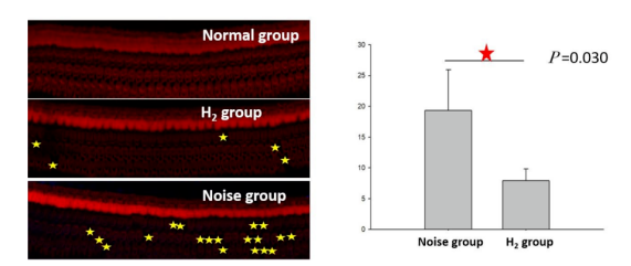 【氢医学·论文】氢气对噪声性聋的防护机制研究(图5)