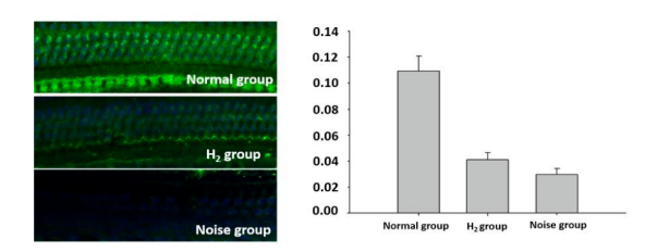 【氢医学·论文】氢气对噪声性聋的防护机制研究(图4)
