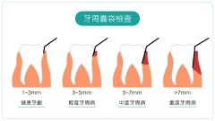 氢气能舒缓牙周炎