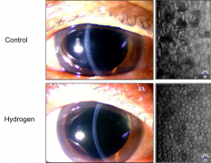 氢气在眼科学领域的应用