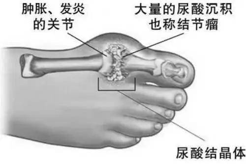 氢气医学研究论文_医学论文氢气研究方法_医学论文氢气研究方向