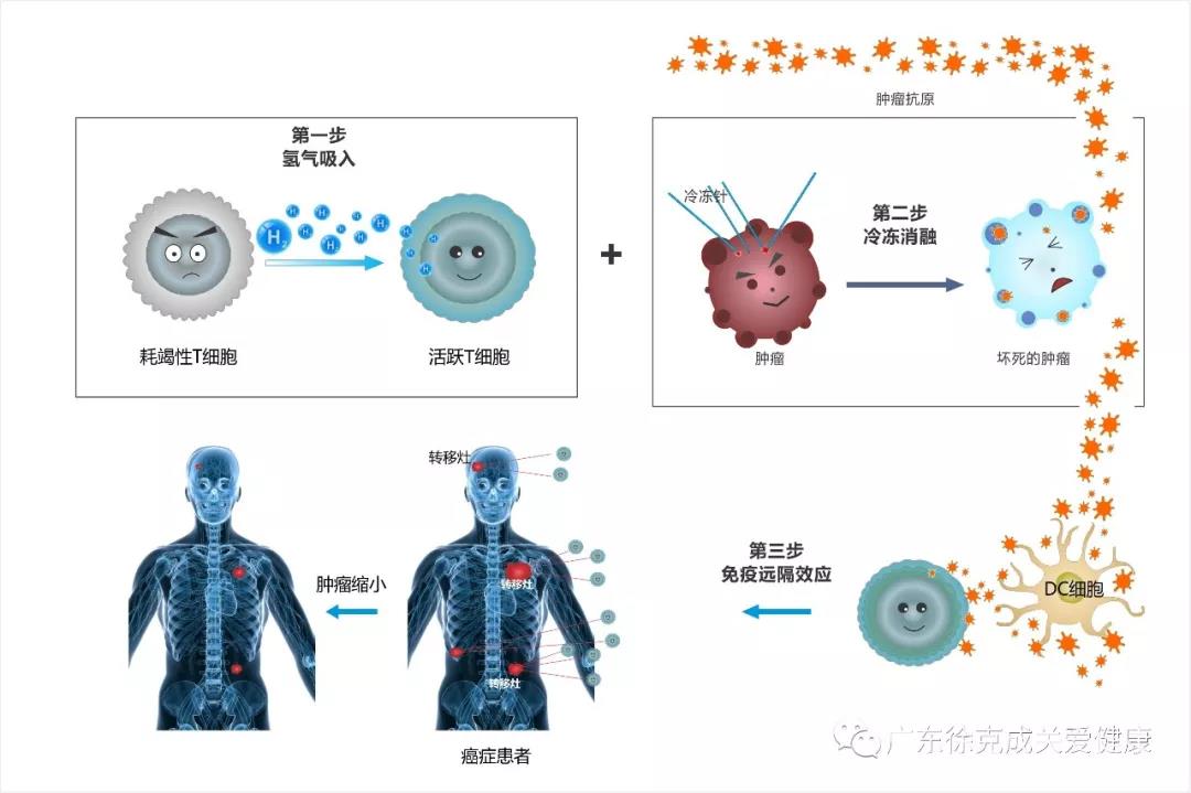 癌症改善氢气加冷冻的“联合”策略受到关注