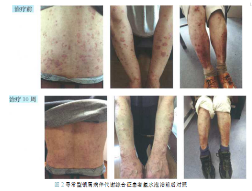 【医学专家谈氢疗】骆肖群：氢疗是皮肤